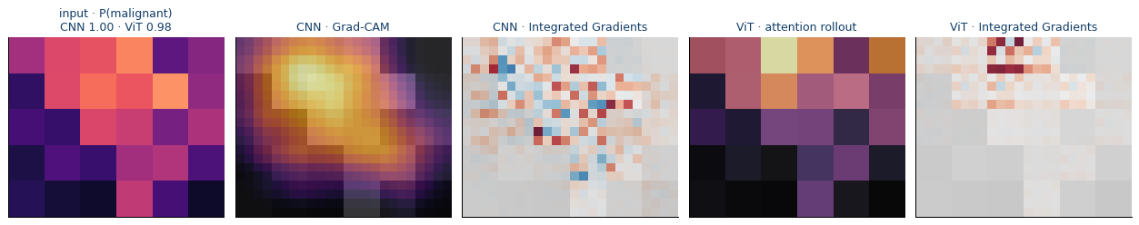 Local explanation maps for one held-out test observation: CNN Grad-CAM and Integrated Gradients alongside ViT attention rollout and Integrated Gradients.